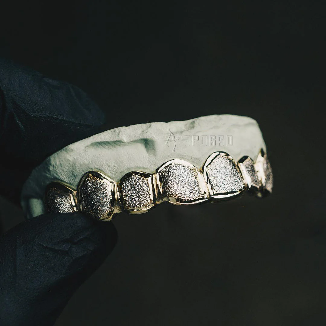 Custom Two Tone Diamond Dust Grillz - Image 5