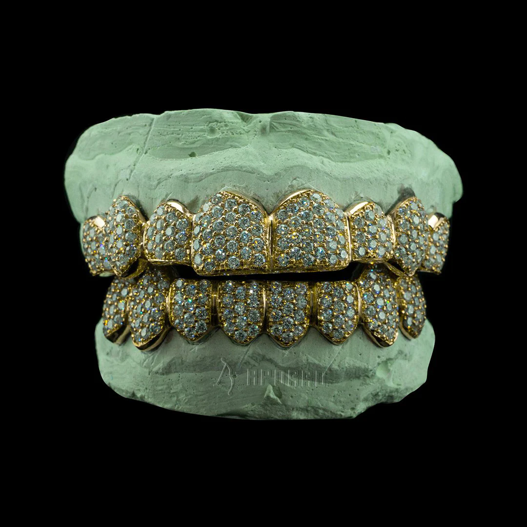 Custom Zig Zag Setting Iced VVS Moissanite Grillz - Image 2