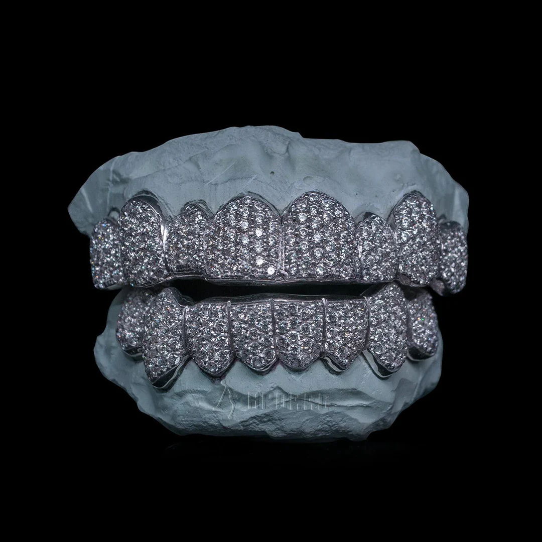 Custom Zig Zag Setting Iced VVS Moissanite Grillz - Image 3